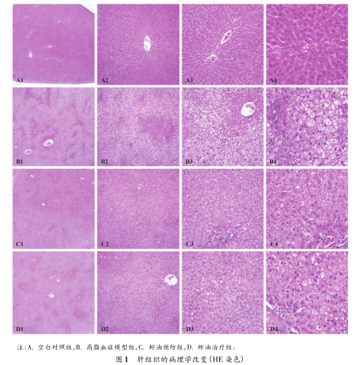 文献精读-南极磷虾油辅助降血脂 预防作用与治疗作用的比较